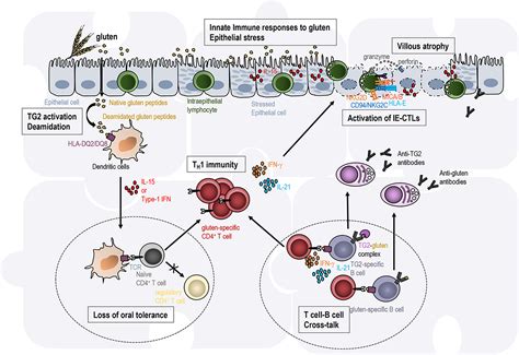 ninjakoltb|Novel association of gluten sensitivity with immune.
